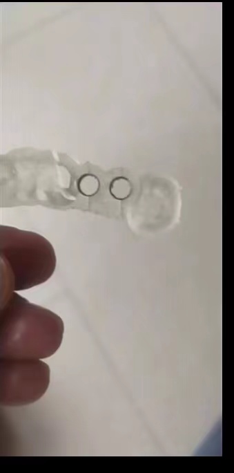 Resin Dental 3D Printer Planti - đánh giá và giá Glue For 3D Printing